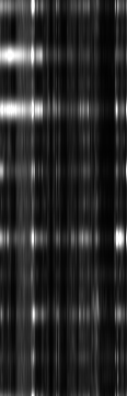 07 RALP _ un1q